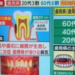 歯周